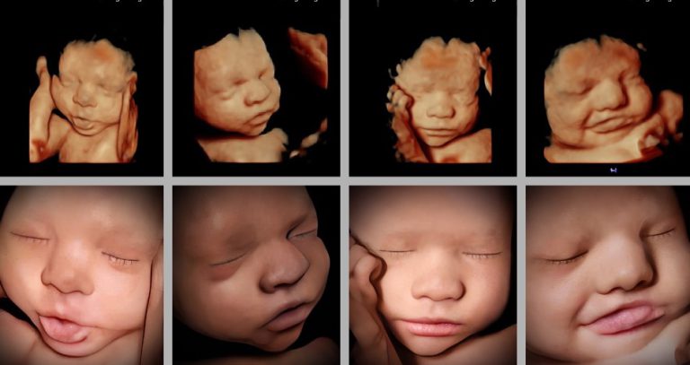 3D Ultrasound in Fort Worth