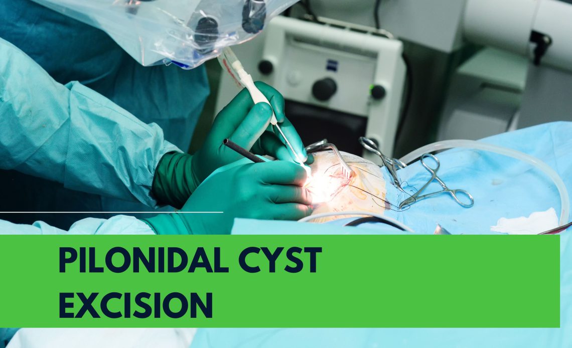 What Are The Steps For Pilonidal Cyst Excision Surgery? - Your Notable ...