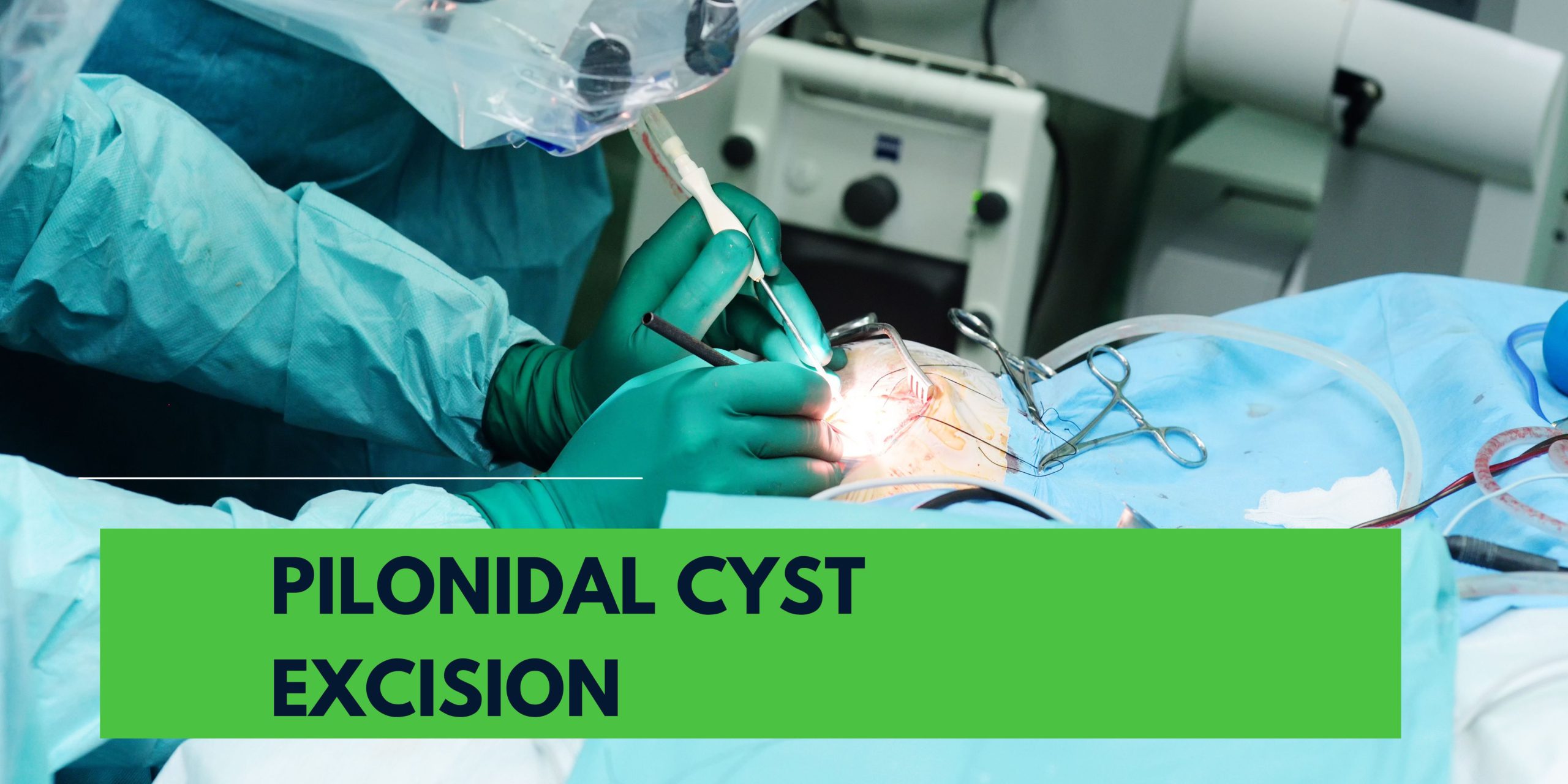 pilonidal cyst excision